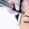 cosmetologist-making-mesotherapy-injection-with-de-1