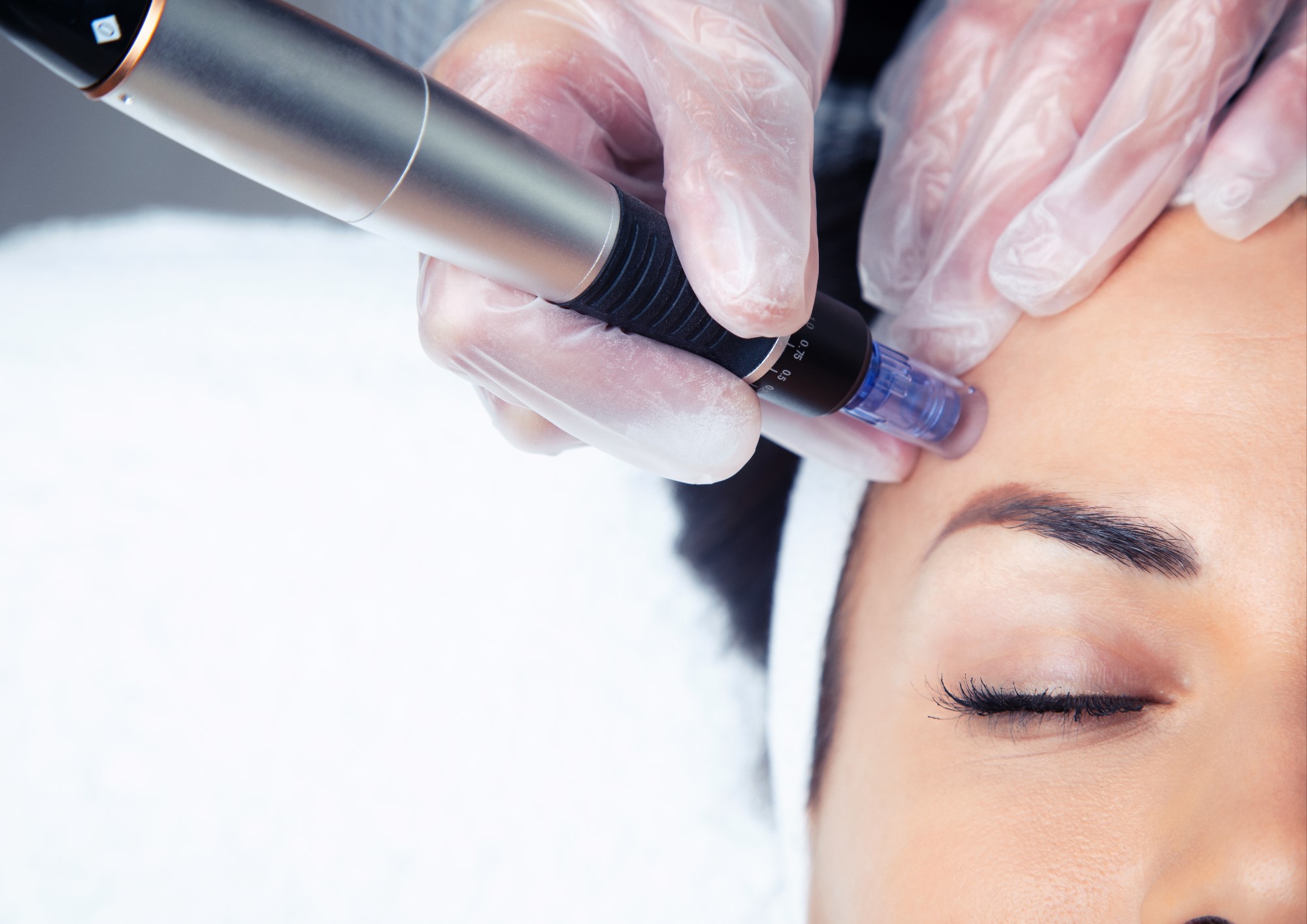 cosmetologist-making-mesotherapy-injection-with-de-1
